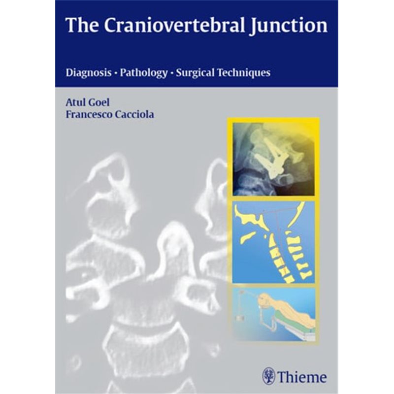 The Craniovertebral Junction - Diagnosis -- Pathology -- Surgical Techniques
